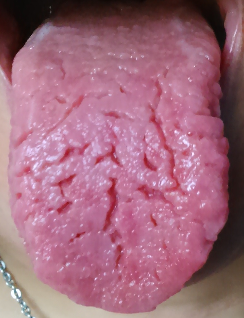 Die Tabletten bei der Impotenz